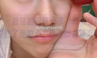 微密圈 – 鹿瑶的眼镜分享，真心觉得是魔法，框住了我的心，也许都是坏习惯吧！